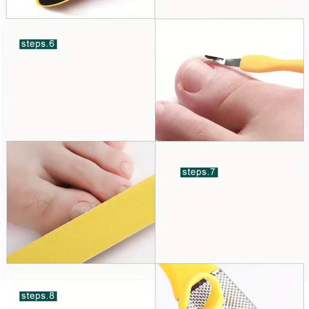 Callus Remover Kit - Picture 13 of 16